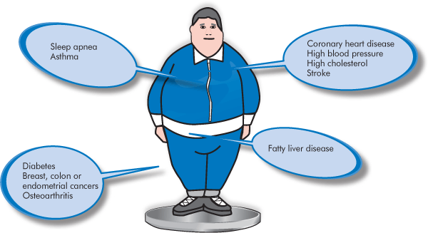 obesity_illustration steps